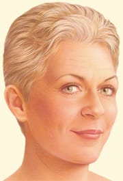 Facelift4 Facelift facts